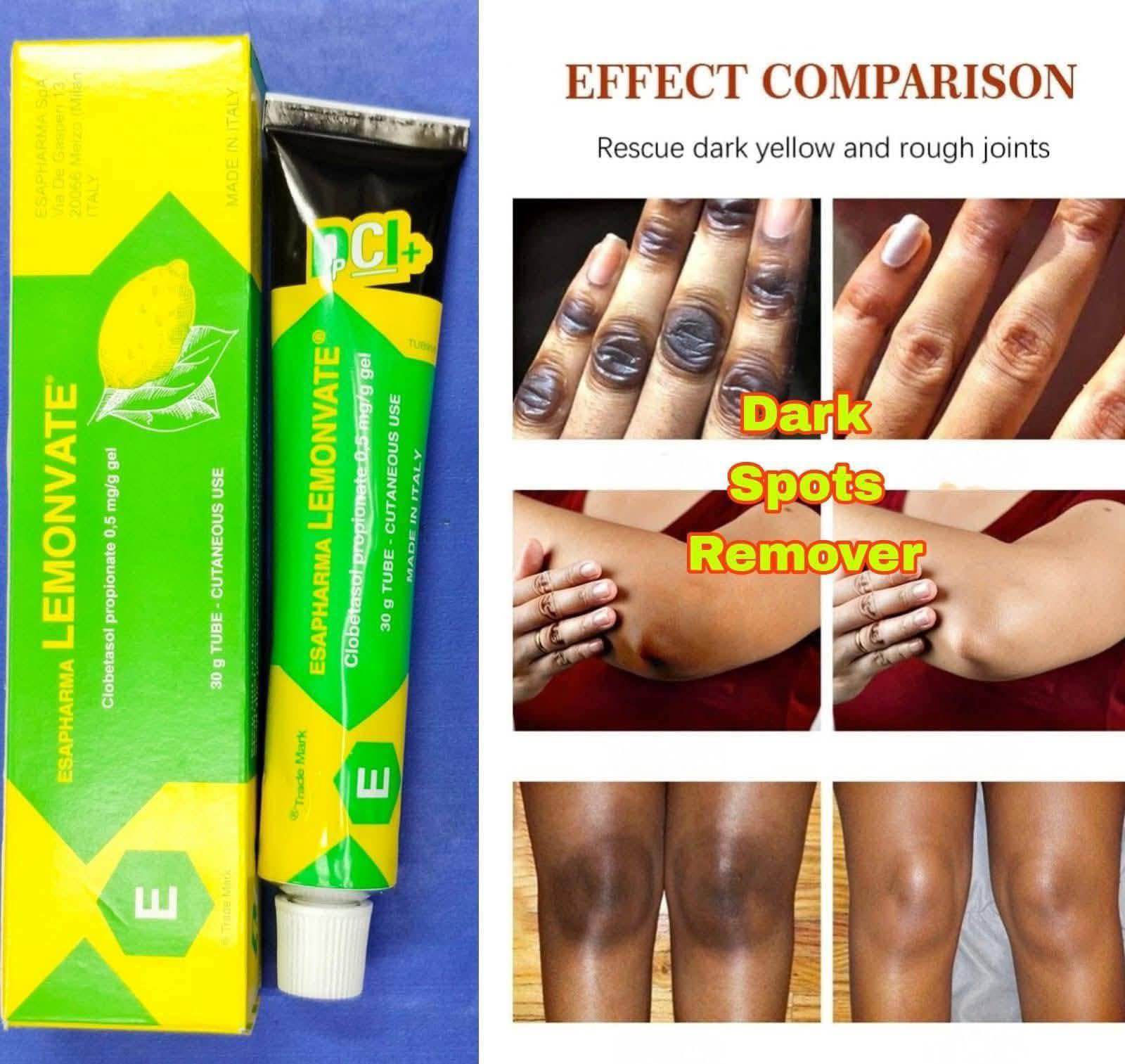 Lemonvate Brightening Cream Vitamin C (ডেলিভারি চার্জ ফ্রি)